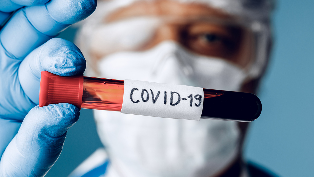 The COVID-19 Pandemic