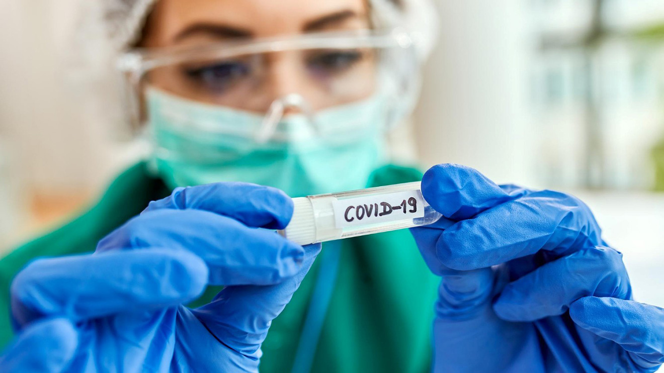 Estimating the reproduction number (R) during the COVID-19 pandemic